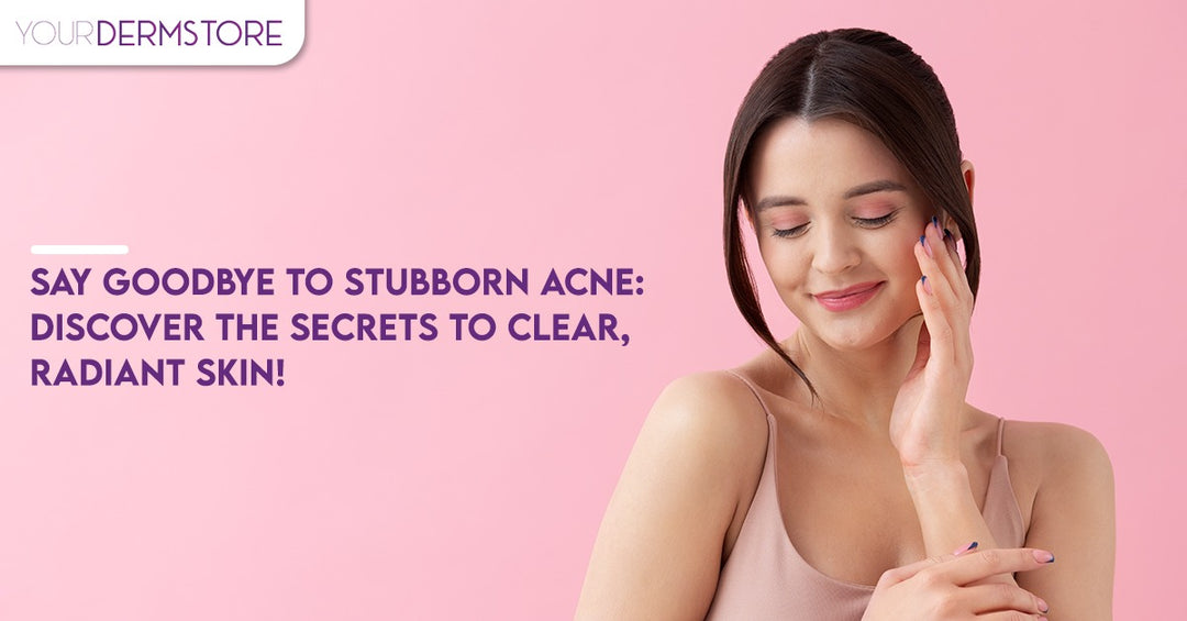 Say Goodbye to Stubborn Acne: Discover the Secrets to Clear, Radiant Skin!
